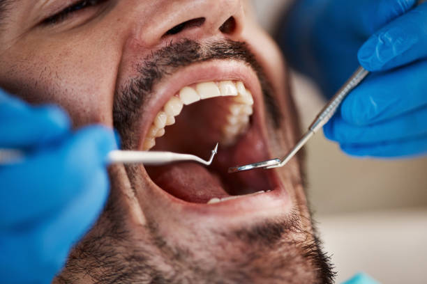 Oral Surgery in Ovid, MI
